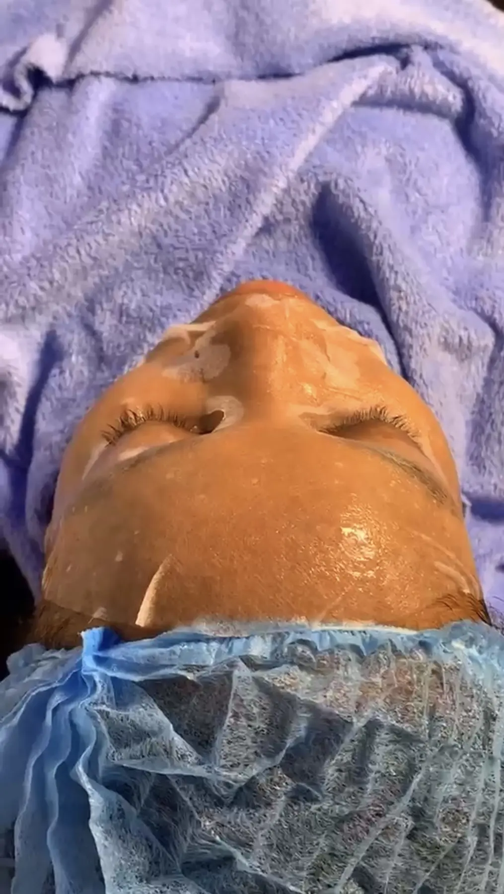 Facial Treatments work 1