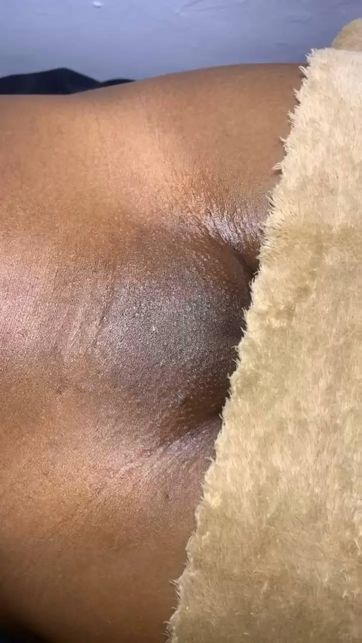 Facial Treatments work 4